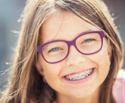Niềng răng bao nhiêu tuổi thì phù hợp – Có nên niềng răng cho trẻ sớm hay không?