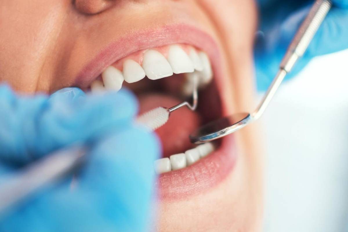 Rụng răng là do nguyên nhân gì? có mọc lại không?