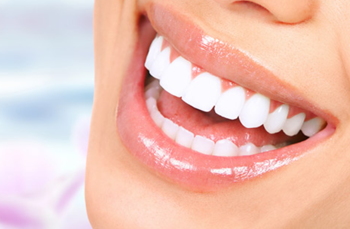  Nhược điểm của bọc răng sứ là Răng sứ khó duy trì tuổi thọ lâu dài 