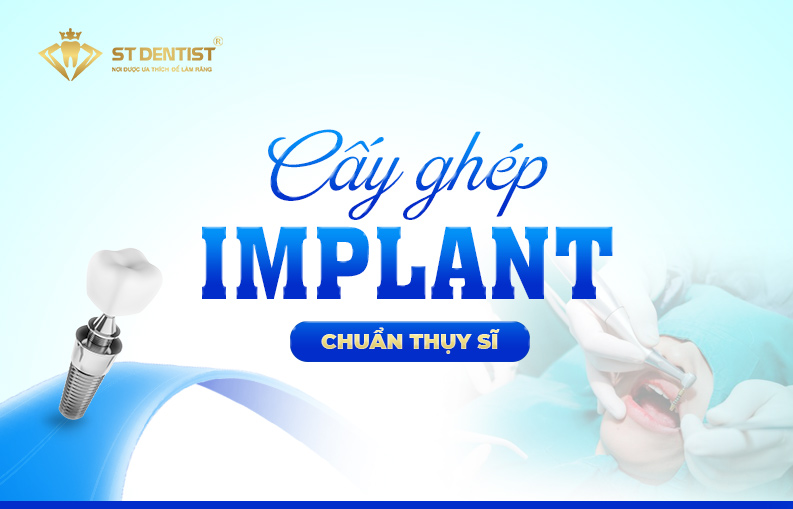 CẤY GHÉP IMPLANT 