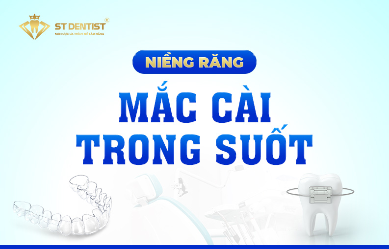 NIỀNG RĂNG CHỈNH NHA