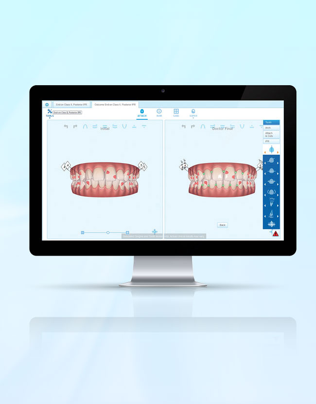 Phần mềm Clincheck