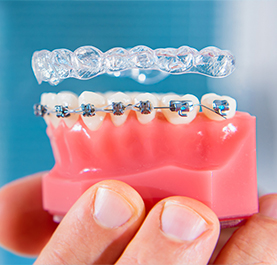 Cải thiện tình trạng răng khiếm khuyết