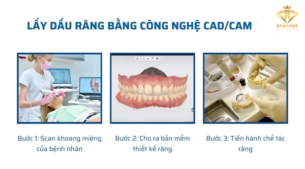 lay-dau-rang-3