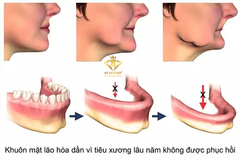 mat-rang-co-nieng-rang-duoc-khong-1