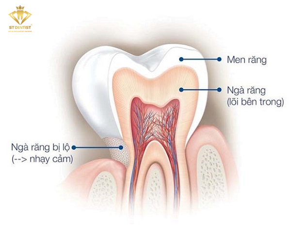 men-rang-la-gi-3