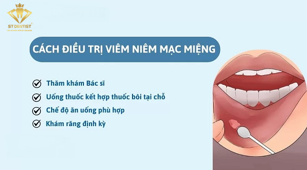 niem-mac-mieng-la-gi-1