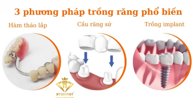 phuong-phap-trong-rang-gia