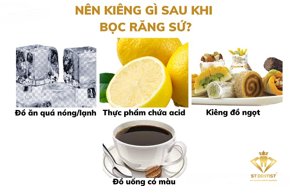 sau-khi-lam-rang-su-nen-kieng-an-gi-1