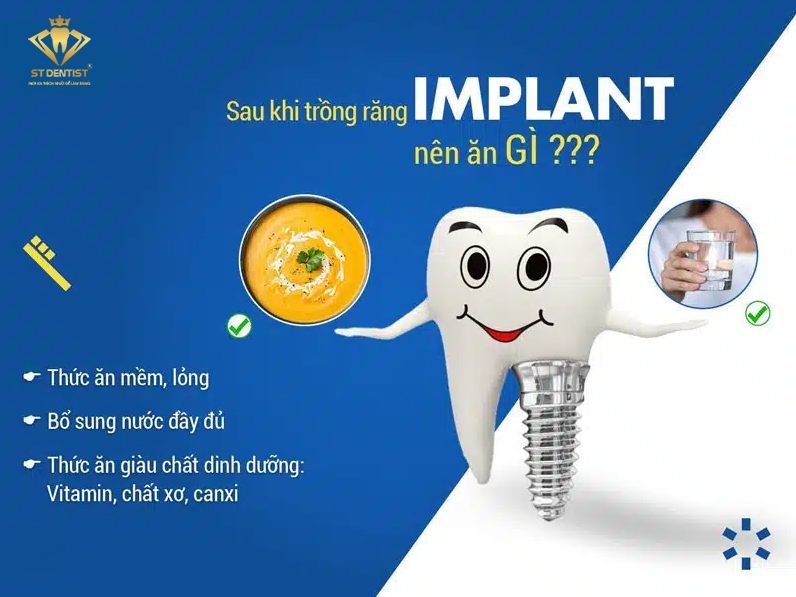 sau-khi-trong-rang-implant-nen-an-gi