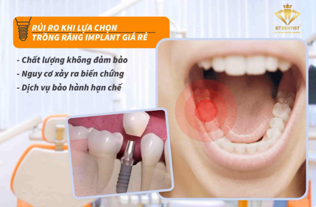 trong-rang-implant-gia-re-co-tot-khong-1