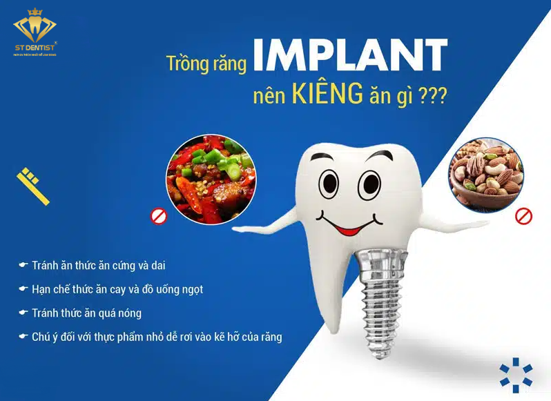 trong-rang-implant-nen-kieng-an-gi