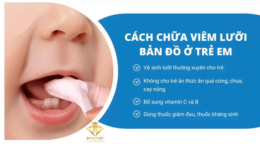 viem-luoi-ban-do-3