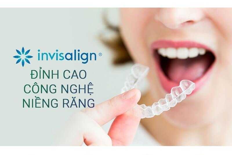 Invisalign - Niềng răng trong suốt và những điều cần biết