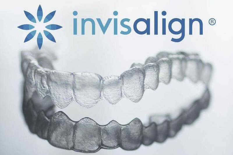 Niềng răng trong suốt Invisalign có gì đặc biệt?