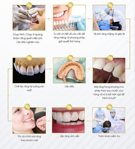 Quy trình bọc răng sứ tại ST Dentist