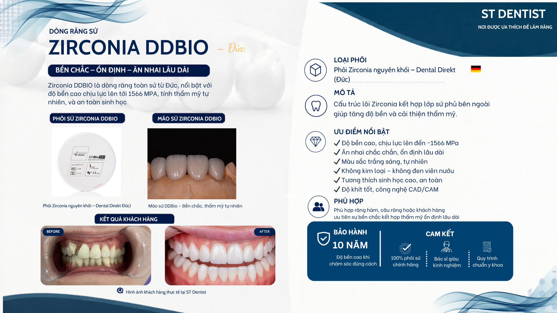 Răng Sứ Zirconia DDBIO Là Gì? Ưu Điểm Của Răng Sứ Zirconia Được Ưa Chuộng Hiện Nay