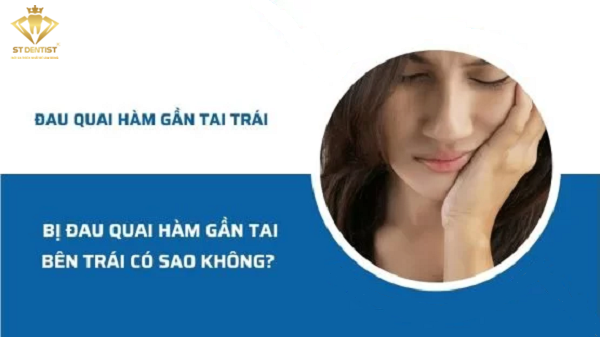 Bị Đau Quai Hàm Gần Tai Bên Trái Có Sao Không【BS.Tư Vấn】