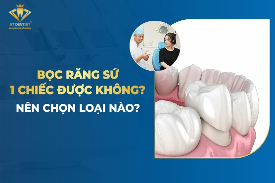 Bọc Răng Sứ 1 Chiếc Được Không【BS.Giải Đáp】