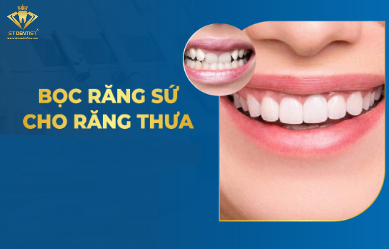 Bọc Răng Sứ Cho Răng Thưa Có Hiệu Quả Không【Tìm Hiểu】