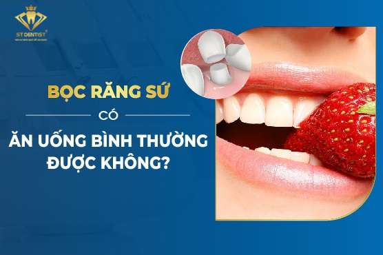 Bọc Răng Sứ Có Ăn Uống Bình Thường Được Không【BS.Tư Vấn】