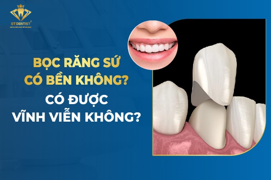 Bọc Răng Sứ Có Bền Không【BS.Tư Vấn】