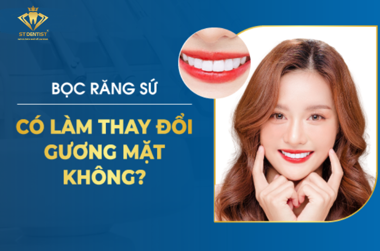 Bọc Răng Sứ Có Làm Thay Đổi Gương Mặt Không【Tìm Hiểu】