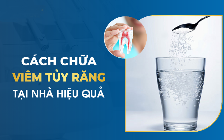 Cách Chữa Viêm Tủy Răng Tại Nhà: Hiệu Quả và An Toàn