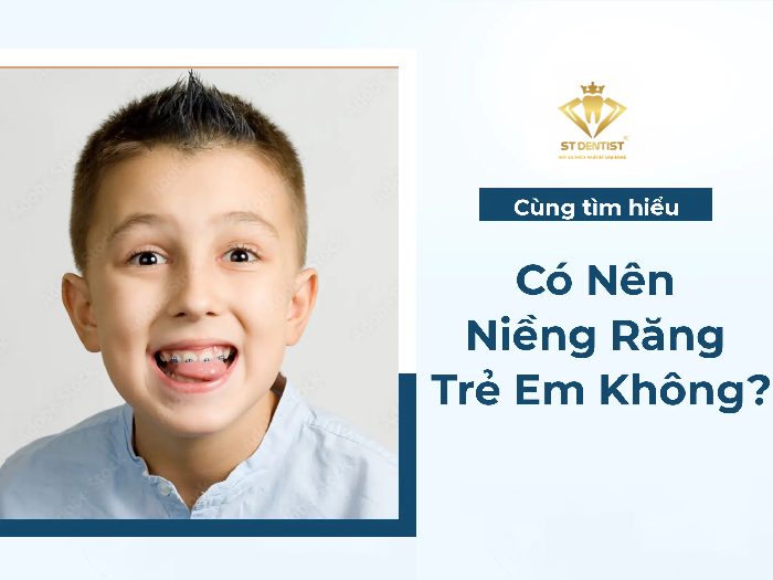 Có Nên Niềng Răng Cho Trẻ Em Không【BS.Giải Đáp】