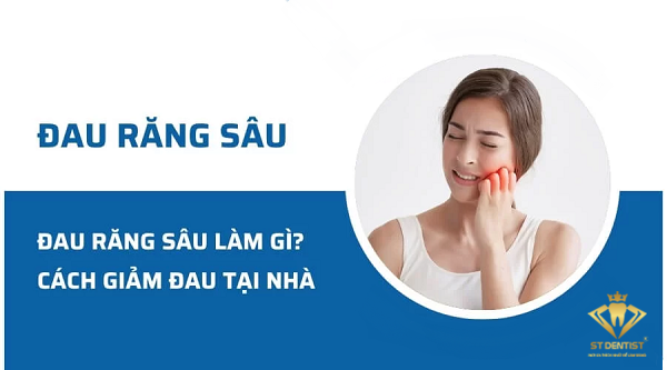 Đau Răng Sâu Nên Làm Gì【BS.Tư Vấn】