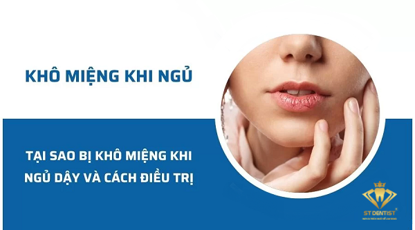 Khô Miệng Khi Ngủ Dậy: Nguyên Nhân Và Cách Điều Trị