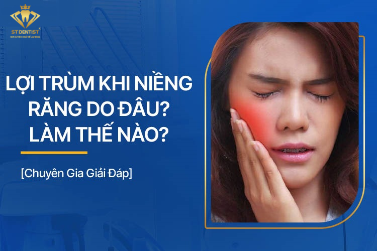 Lợi Trùm Khi Niềng Răng Phải Làm Sao【BS.Giải Đáp】