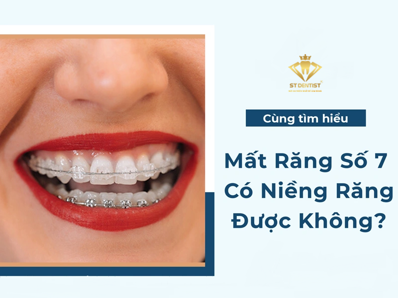 Mất Răng Số 7 Có Niềng Răng Được Không【BS.Tư Vấn】