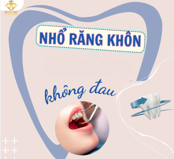 Nhổ Răng Khôn Không Đau: Sự Thật Và Giải Pháp Hiệu Quả