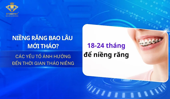 Niềng Răng Bao Lâu Thì Tháo Được【BS.Tư Vấn】