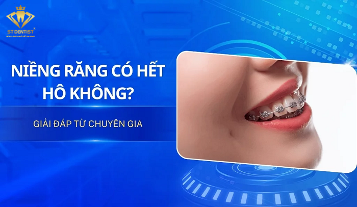 Niềng Răng Có Hết Hô Không【BS.Giải Đáp】