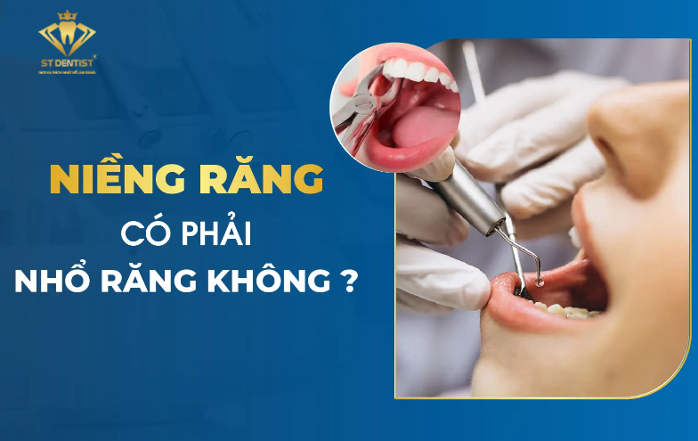 Niềng Răng Có Phải Nhổ Răng Không【BS.Giải Đáp】