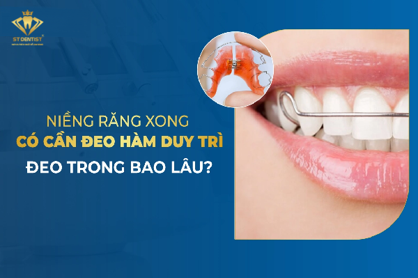 Sau Niềng Răng Đeo Hàm Duy Trì Bao Lâu【Tìm Hiểu】