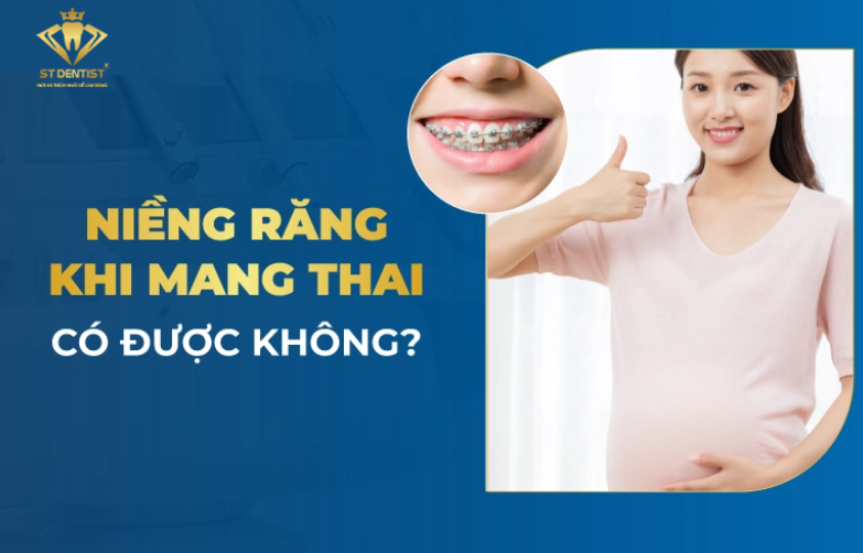 Niềng Răng Khi Mang Thai Có Được Không【BS.Tư Vấn】