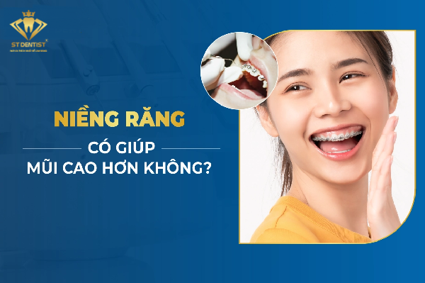 Niềng Răng Mũi Có Cao Lên Không【BS.Tư Vấn】