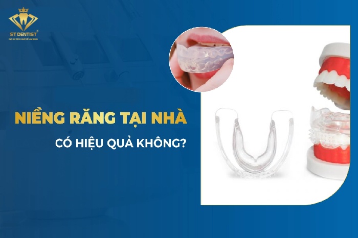 Niềng Răng Tại Nhà Có Hiệu Quả Không【BS.Tư Vấn】