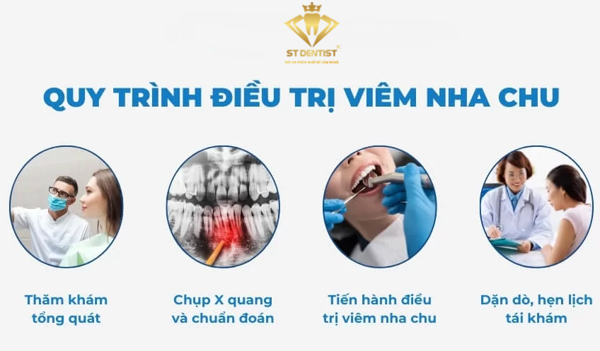 Quy Trình Điều Trị Viêm Nha Chu Hiệu Quả Và An Toàn【BS.Tư Vấn】