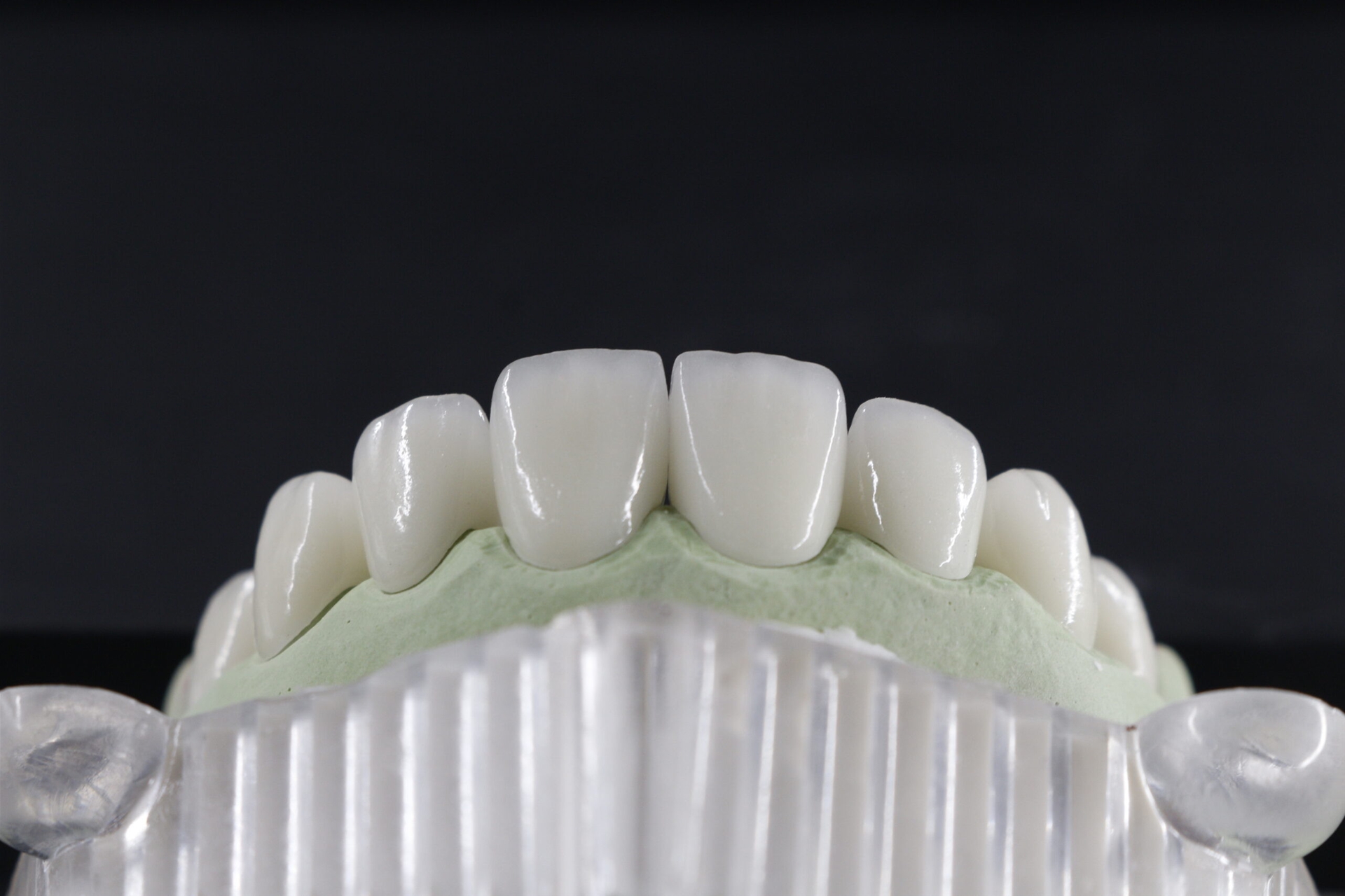 Răng sứ Zirconia DDBIO được ưa chuộng nhờ tính chất vượt trội