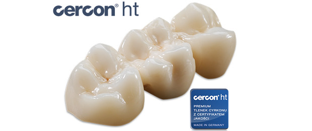 Răng sứ Cercon HT - một trong những dòng răng được ưa thích nhất tại St Dentist