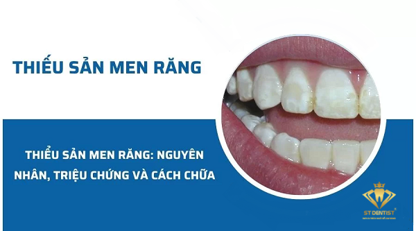 Thiếu Sản Men Răng: Nguyên Nhân Và Cách Điều Trị