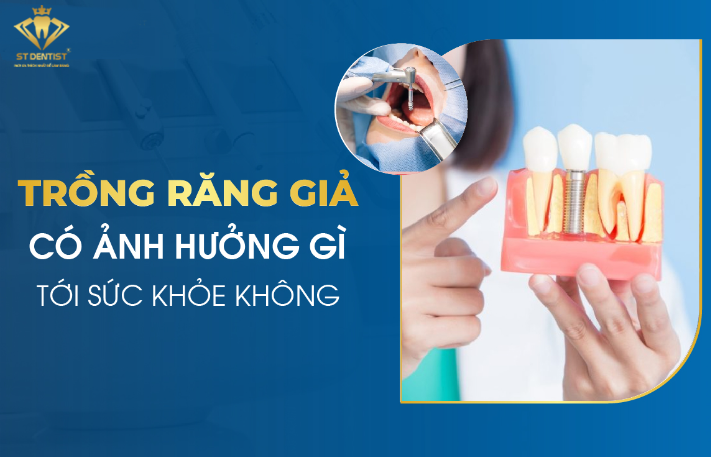 Trồng Răng Giả Có Ảnh Hưởng Gì Không【BS.Tư Vấn】