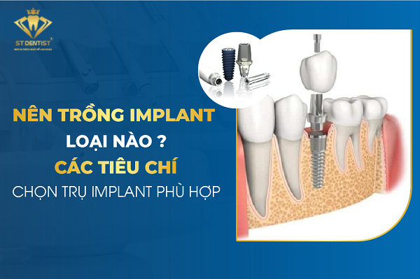 Trồng Răng Implant Loại Nào Tốt【BS.Tư Vấn】