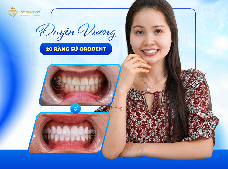 Hiệu quả trước và sau CỦA KHÁCH HÀNG
TẠI ST DENTIST