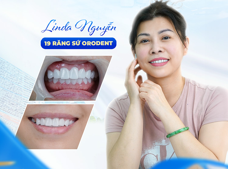 Hiệu quả trước và sau CỦA KHÁCH HÀNG
TẠI ST DENTIST