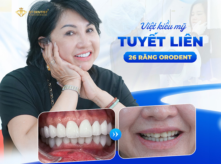 Hiệu quả trước và sau CỦA KHÁCH HÀNG
TẠI ST DENTIST